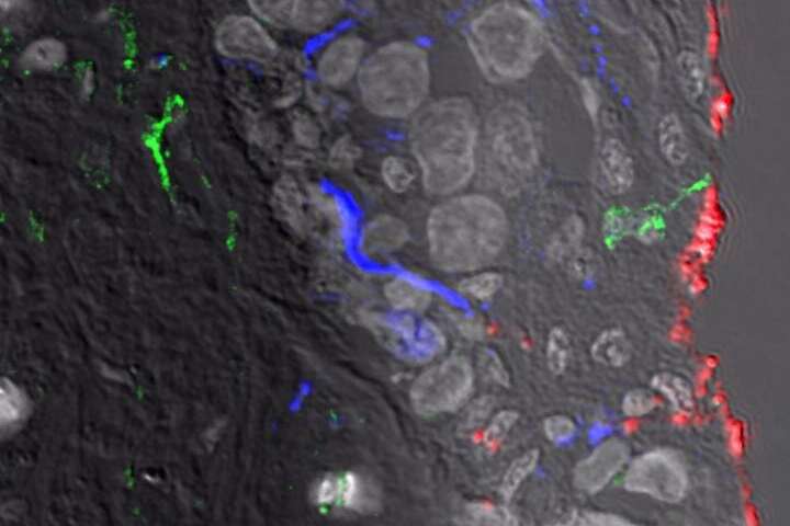 Newly discovered immune cells at the frontline of HIV infection