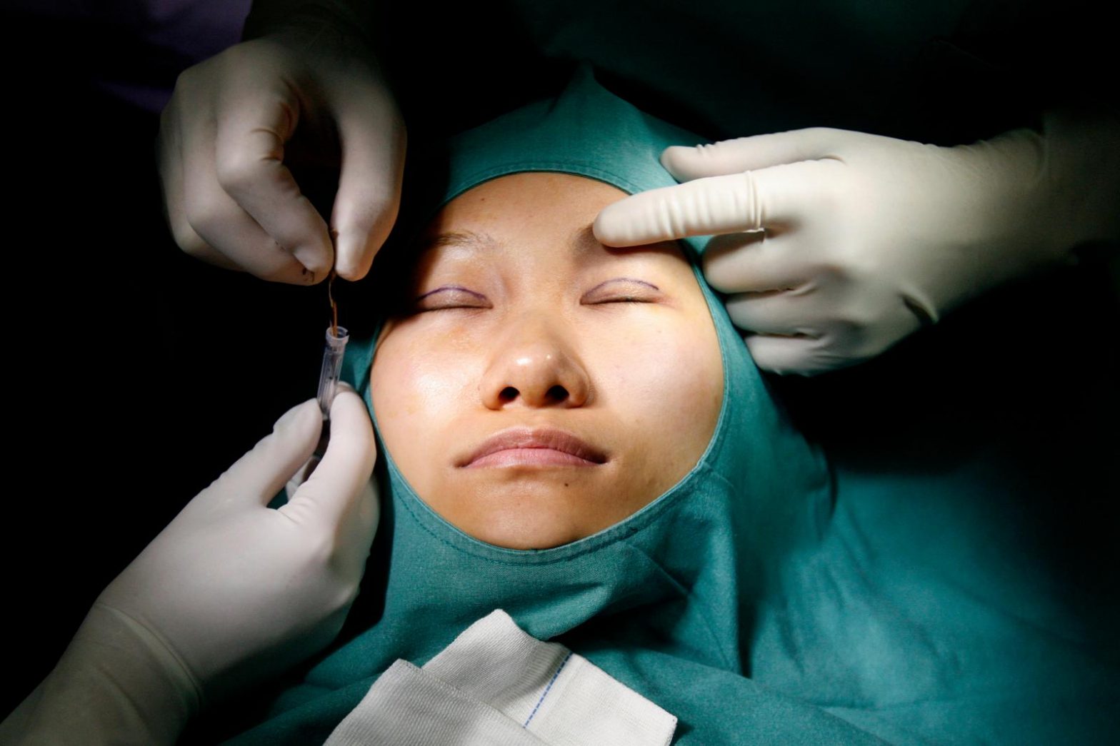Plastic surgery clients are getting younger—and doctors say selfies are to blame
