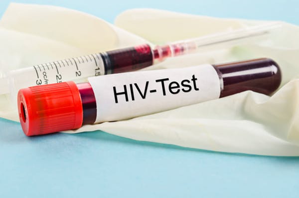 Should you be tested for HIV?