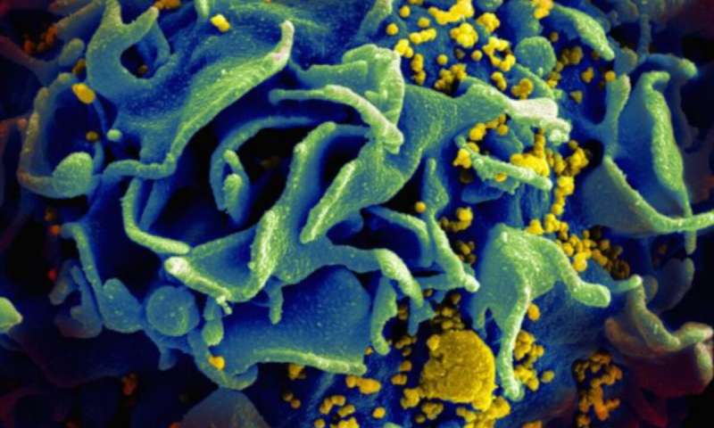 Novel method identifies patients at risk for HIV who may benefit from prevention strategies