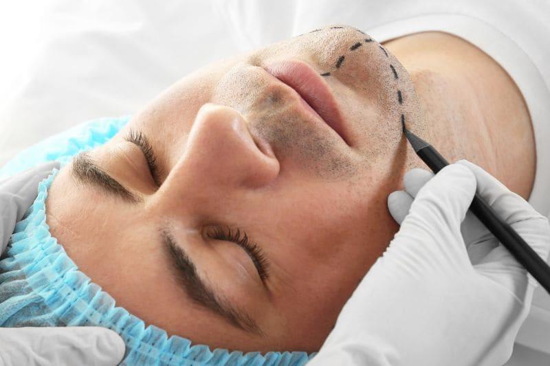 Men look more attractive, trustworthy after plastic surgery, study shows