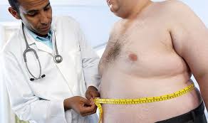 OBESITY SHOULD BE RECOGNISED AS A DISEASE, MEDICAL EXPERTS SAY