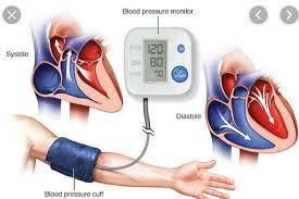 Hypertension prevalence high in Mukono, Buikwe districts