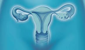 What Women Should Know About the FDA’s Endometrial Cancer Combination Approval