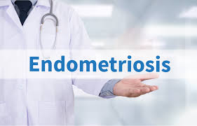 Implantation failures with infertility-associated endometriosis