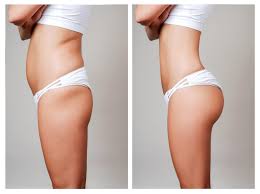 What Tummy Tuck Surgery Is Very Much Essential?