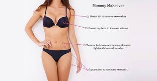 Mommy Makeover: Everything You Need To Know