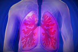 People living with HIV diagnosed with COPD 12 years younger than HIV-negative people