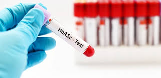 Diabetes: HbA1c level decreased in Delhi during October-December 2019