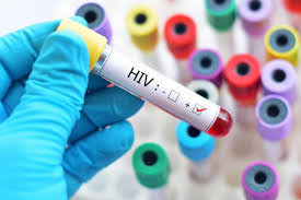 Mizoram tops in HIV/AIDS cases