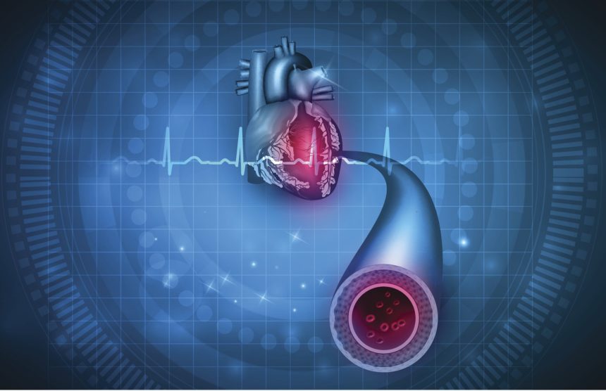 Subclinical Cardiovascular Disease Similar Despite HIV, Stratified Across Subpopulations