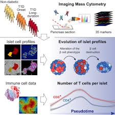 Metabolic alterations in immune cells associate with progression to type 1 diabetes