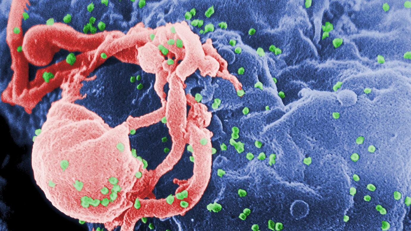 Researchers discover how a small molecule is the key to HIV forming capsules