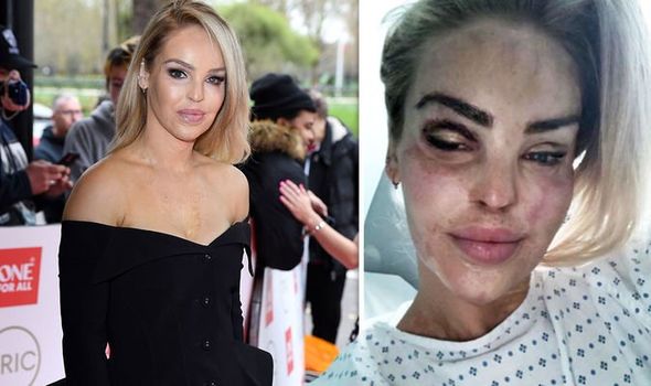 EXCLUSIVE: ‘She went blind for a few days’: Katie Piper undergoes surgery on her healthy eye due to complications from 2008 acid attack – and has now had over 350 operations