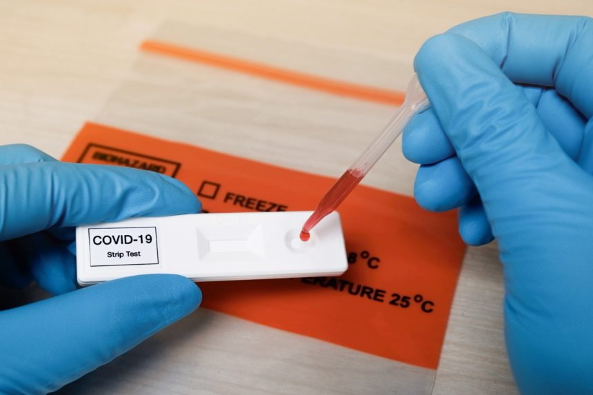 People With HIV May Have a Higher Susceptibility to COVID-19