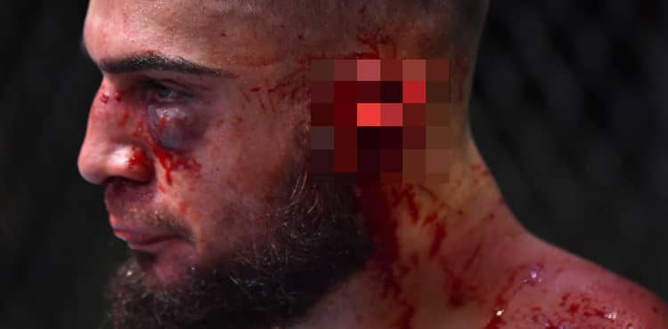 UFC VEGAS 13 FIGHTER NEARLY LOSES EAR (WARNING: GRAPHIC IMAGE); PEERS REACT WITH SHOCK