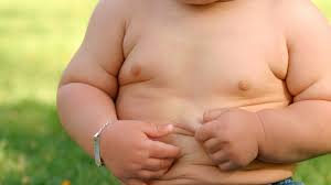 Will your overweight child outgrow their “baby fat”?
