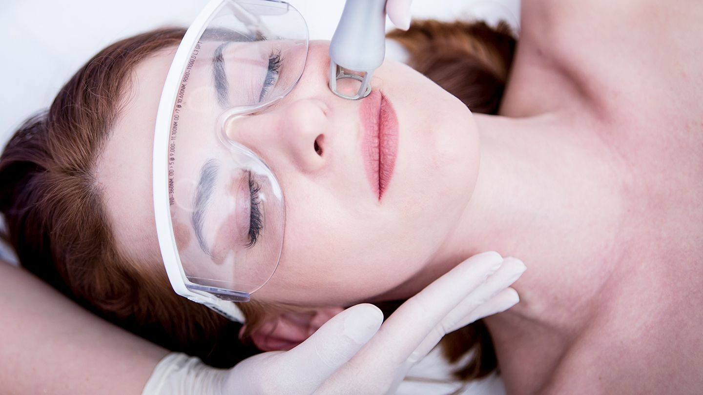 What is Skin resurfacing & how its getting done? - MyMedicPlus